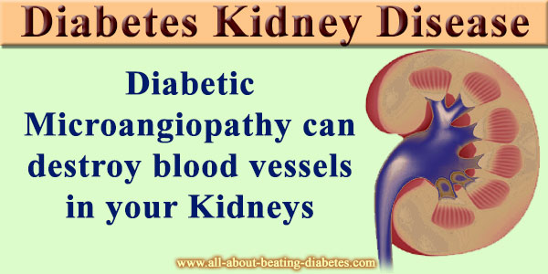 diabetes-kidney-disease-pathogenesis-and-prevention